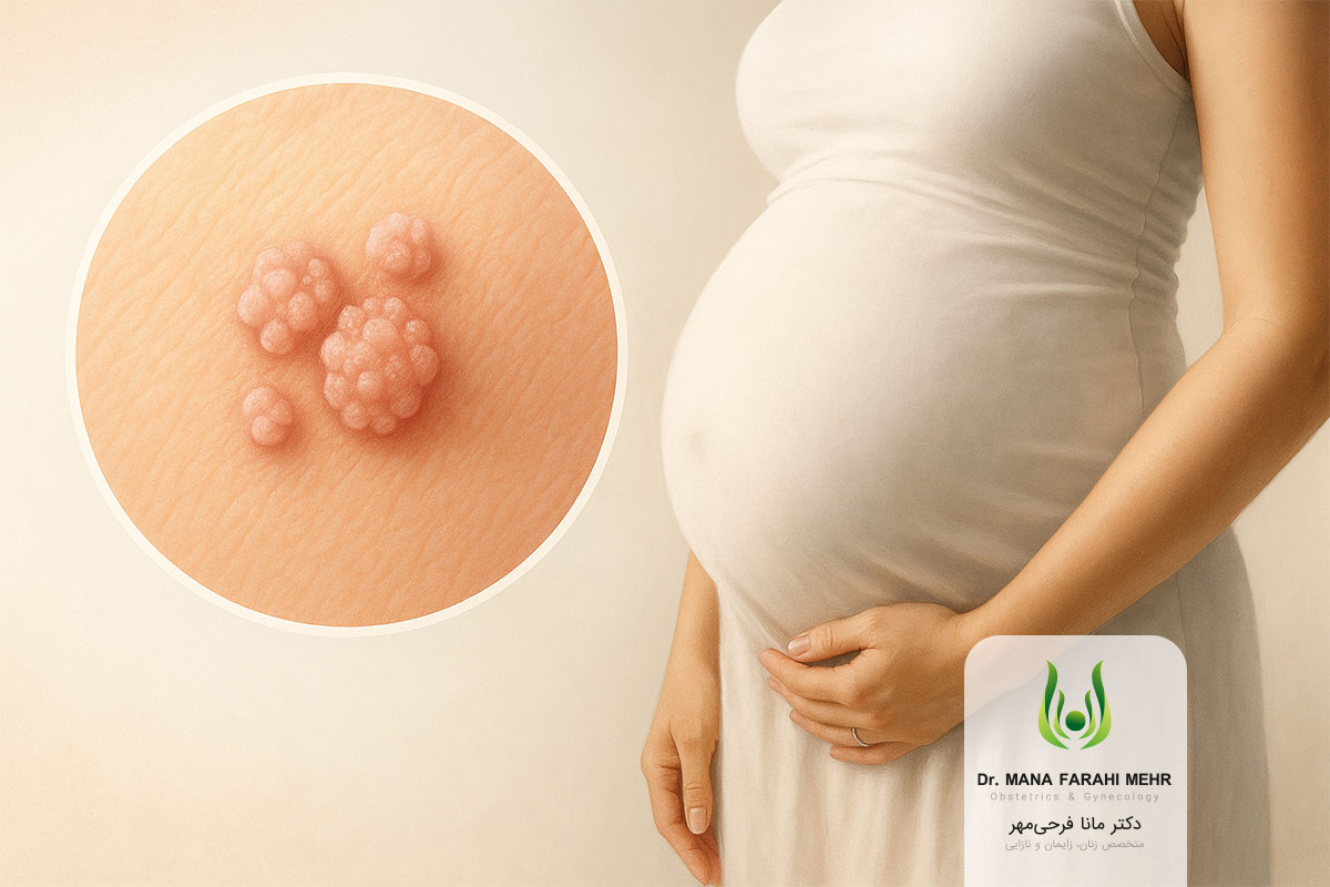 زگیل تناسلی در بارداری و اهمیت مراجعه به پزشک متخصص