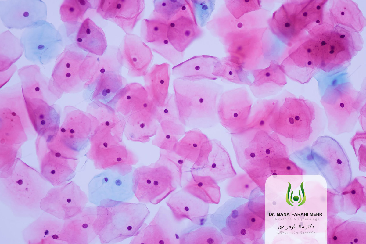 تصویری از نتیحه آزمایش پاپ اسمیر